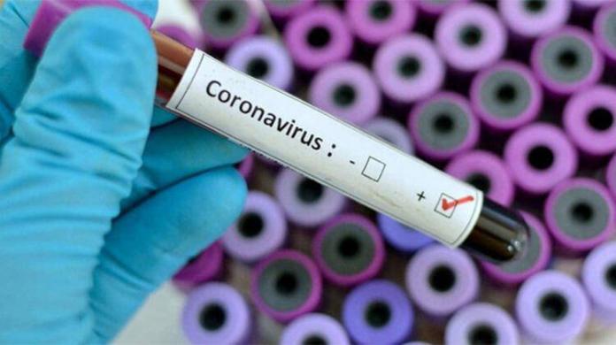 online coronavirüse testi